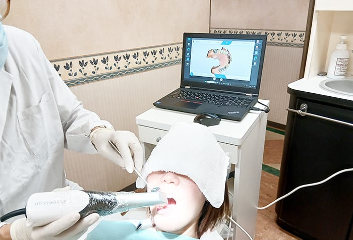 インプランター