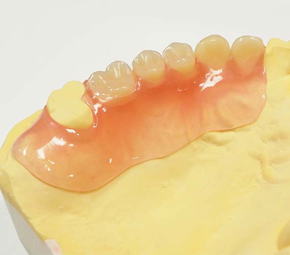 やわらかくてよく噛めるソフトデンチャー