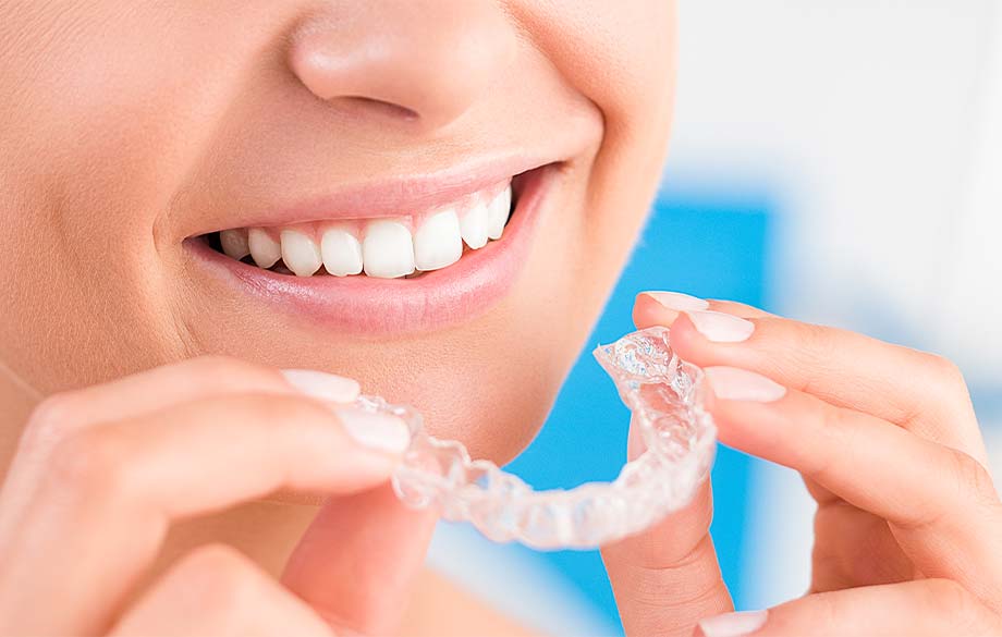 マウスピース矯正に力を入れています